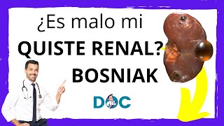 Quiste Renal Complejos Clasificación de Bosniak ¿Pueden dar cáncer los quistes renales [upl. by Leuams104]