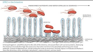 Enteropathogenic Escherichia coli E Coli  Characteristics Symptoms Diagnosis Treatment [upl. by Hnacogn523]