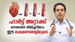 ഹാർട്ട് അറ്റാക്ക് എങ്ങനെ നേരത്തെ തിരിച്ചറിയാം  Heart Attack Malayalam Health Tips [upl. by Merell]