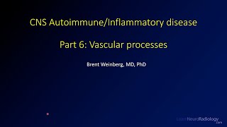 Imaging CNS autoimmune and inflammatory disease  6  Vascular [upl. by Alva]