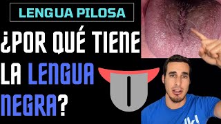 ¿Por qué tiene la LENGUA NEGRA  Pilosa [upl. by Nessie502]