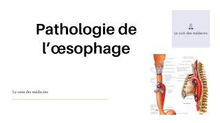 Pathologie de l’œsophage [upl. by Hsima]