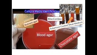 Culture media the simplest way of identification  Blood MacConkey  Chocolate RCM Nurient agar [upl. by Eladnyl182]