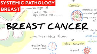 Breast Cancer  Anatomy  causes  classification  Treatment  staging  prognostic amp Risk factors [upl. by Limemann]