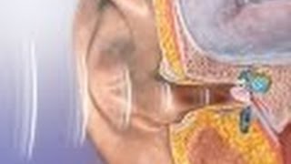 Middle ear tympanic cavity anatomy [upl. by Balthasar467]