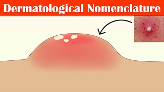 Describing Skin Lesions Dermatological Nomenclature  Macule Papule Pustule Vesicle amp Others [upl. by Dry]