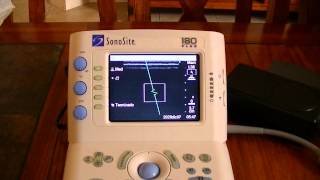 Sonosite 180 Plus d [upl. by Ahsac]