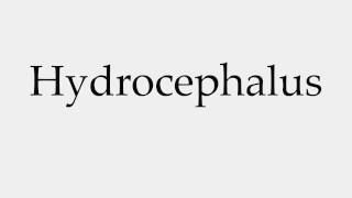 How to Pronounce Hydrocephalus [upl. by Carlynne]