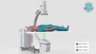 Allengers Radiation Safety Protocol for C Arm Machine Animated video [upl. by Kelly484]