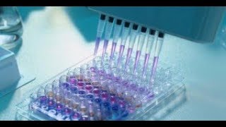 Test ELISA [upl. by Onoitna]