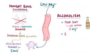 Hypomagnesemia causes symptoms diagnosis treatment pathology [upl. by Yt605]