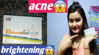 Dermadew Acne Soap review  honest review by be alert product 👍👎 [upl. by Nylime]