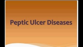 USMLE What you need to know about Peptic Ulcer Disease by usmleTeam [upl. by Kciredes375]