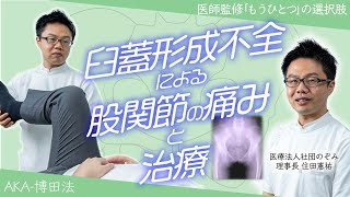 臼蓋形成不全による股関節の痛みと治療 [upl. by Ardnohs]