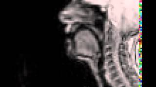 Voiced uvular trill MRI [upl. by Barbee]