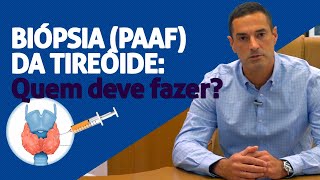 QUAIS NÓDULOS DEVEM FAZER A PAAF BIÓPSIA DA TIREÓIDE [upl. by Jahdol]