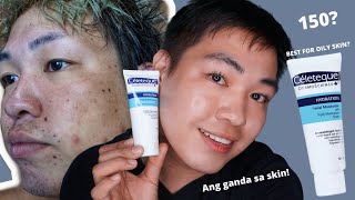 CELETEQUE MOISTURIZER REVIEW IS IT GOOD FOR ACNE PRONE SKIN [upl. by Vachill]