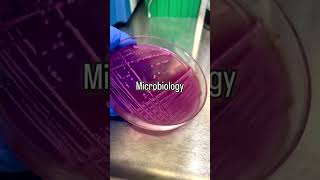 Microbilogy ScienceMicrobiologyBacteriaLabLifeExperimentSTEMResearchPetriDishBiology [upl. by Llednohs]