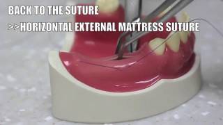 Back to the suture  5 Horizontal external mattress suture [upl. by Lehteb422]