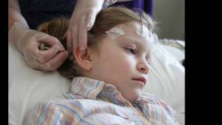 Pediatric Ambulatory EEG for Epilepsy and Seizure Disorders in Children [upl. by Bowes675]