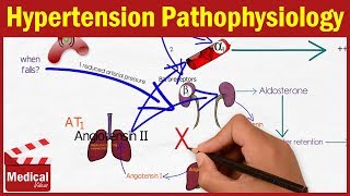 Pharmacology CVS 2 Hypertension Pathophysiology MADE EASY  Renin Angiotensin Aldosterone System [upl. by Dde]