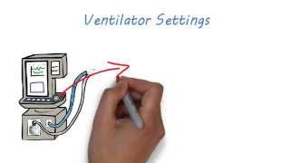 Mechanical Ventilation 101 [upl. by Behka228]