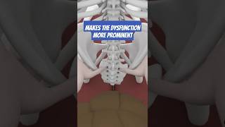 STOP Misdiagnosing Forward Sacral Torsion with This Simple Test [upl. by Neve426]