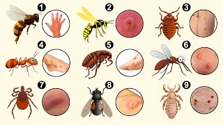 if YOU know  10 Bug Bites Anyone Should Be Able to Identify [upl. by Burhans]