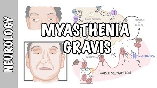 Myasthenia Gravis  symptoms pathophysiology investigations treatment [upl. by Acinorahs153]