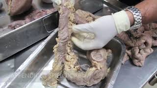 Anatomy Dissection of Large amp Small Intestine [upl. by Mosera]