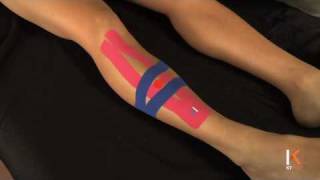 KT Tape Shin Splints Anterior [upl. by Arriet378]