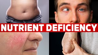 13 Signs Your Body is Deficient in Nutrients [upl. by Ettenav]