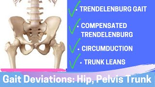 Gait Deviations Hip Pelvis Trunk [upl. by Zins]