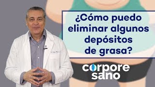 ¿Cómo puedo eliminar los depósitos de grasa  Corpore Sano [upl. by Rodolph400]