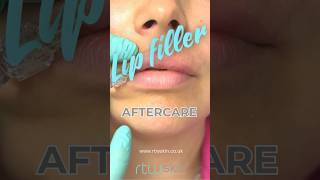 Your lip filler results depend on great aftercare You need to know this lipfiller aftercare [upl. by Newlin]