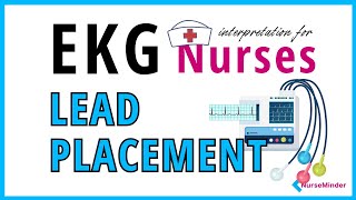 ECG for Nurses 3 5 and 12 Lead Placement electrocardiogram [upl. by Asilef749]