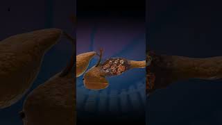 3D Animation of Pancreas Damage Medical Animation [upl. by Dracir]