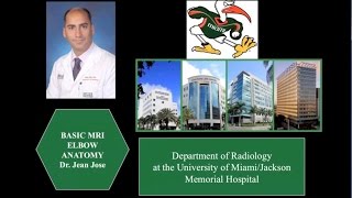 Lumbar spine MRI scan protocols positioning and planning [upl. by Herculie]