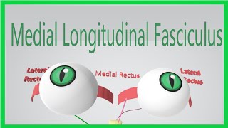 Medial Longitudinal Fasciculus Made Ridiculously Simple [upl. by Malita357]