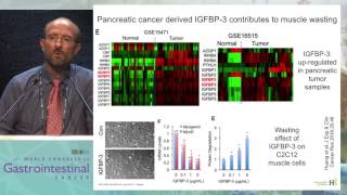 Cancer cachexia and sarcopenia in GI cancer Mechanism and ways to interfere with it [upl. by Hastie]