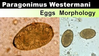 Paragonimus Westermani Eggs Morphology [upl. by Lindell]