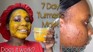 7 Day Turmeric Face Mask For Dark Spots  Honest Review [upl. by Atteras]