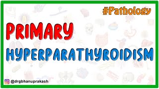 Primary Hyperparathyroidism  Etiology  Pathogenesis  Pathology  Diagnosis and Treatment [upl. by Helen]