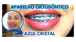 APARELHO ORTODÔNTICO COR AZUL CRISTAL [upl. by Carlo536]