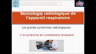 le syndrome de comblement alvéolaire sémiologie radiologie lesgrandssyndromesradiologique [upl. by Eirellav]