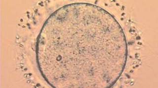 Fertilizationwmv [upl. by Bev]