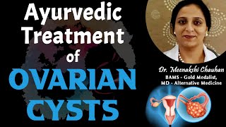 Ayurvedic Treatment of Ovarian Cysts  Dr Meenakshi Chauhan Chandigarh [upl. by Aihseuqram]