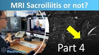 Sacroiliitis or not  with Prof Hermann  Part 4 [upl. by Lattie]