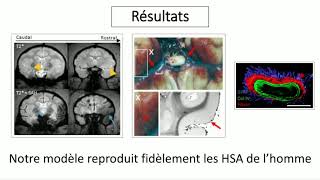 Hémorragies digestives sous anticoagulants  Comment les prévenir  Comment les gérer [upl. by Costin]