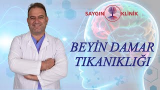 Beyin Damar Tıkanıklığı Tedavileri [upl. by Levan]